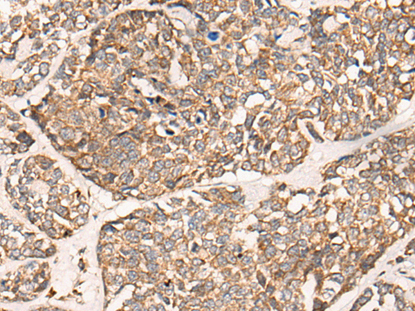 Rabbit Polyclonal Antibody to DGKI