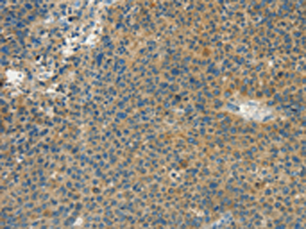 Rabbit Polyclonal Antibody to CALCA