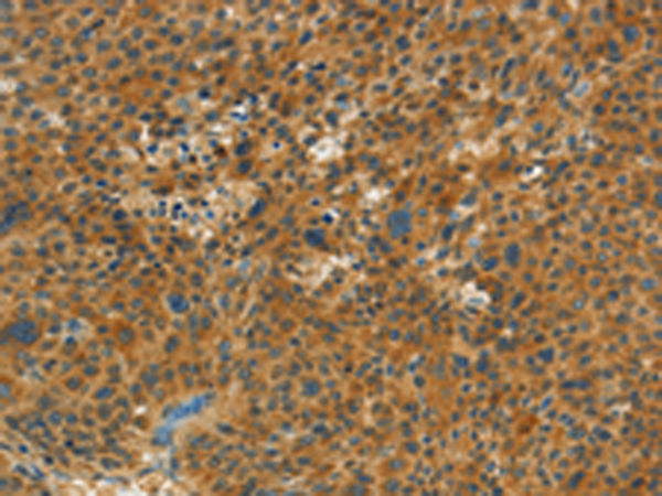 Rabbit Polyclonal Antibody to NPAP1