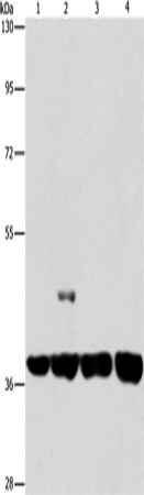 Rabbit Polyclonal Antibody to SERPINA9