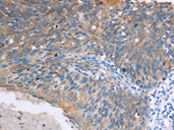 Rabbit Polyclonal Antibody to ELP3