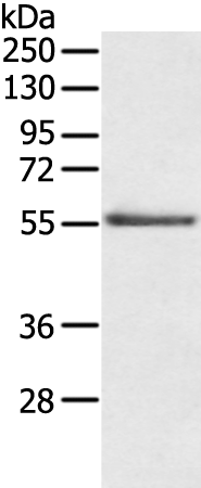Rabbit Polyclonal Antibody to SLC29A1