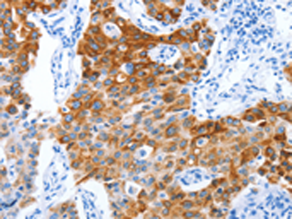 Rabbit Polyclonal Antibody to PROM1