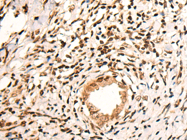 Rabbit Polyclonal Antibody to KMT2C