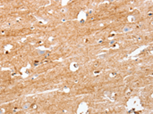 Rabbit Polyclonal Antibody to S100B