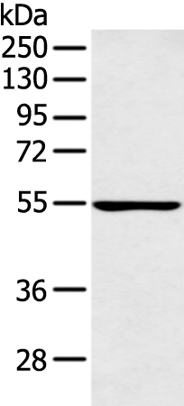 Rabbit Polyclonal Antibody to PFKFB4