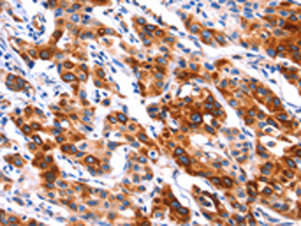 Rabbit Polyclonal Antibody to SEPTIN4
