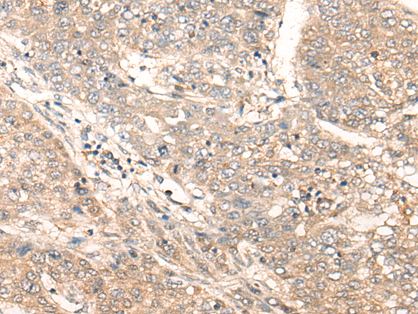 Rabbit Polyclonal Antibody to ACER1