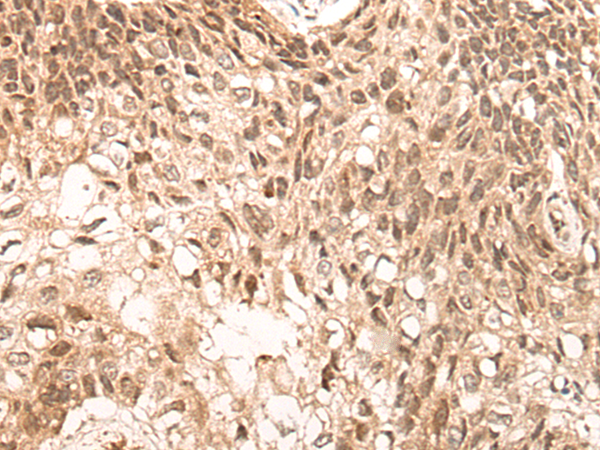 Rabbit Polyclonal Antibody to NCOA6