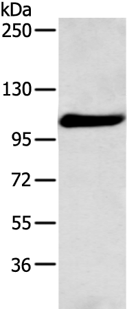 Rabbit Polyclonal Antibody to FOLH1