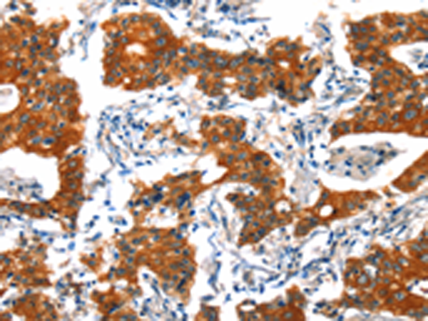 Rabbit Polyclonal Antibody to HTR3B