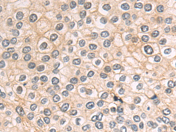 Rabbit Polyclonal Antibody to SLC6A4