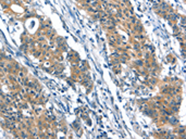 Rabbit Polyclonal Antibody to A4GALT