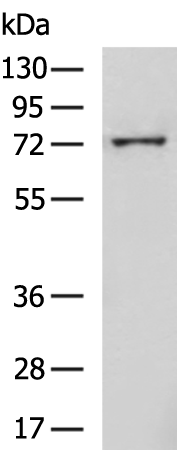Rabbit Polyclonal Antibody to ALOX15