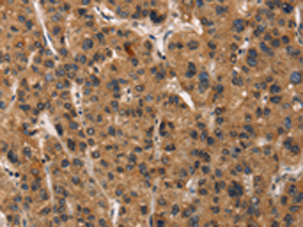 Rabbit Polyclonal Antibody to DEFA5