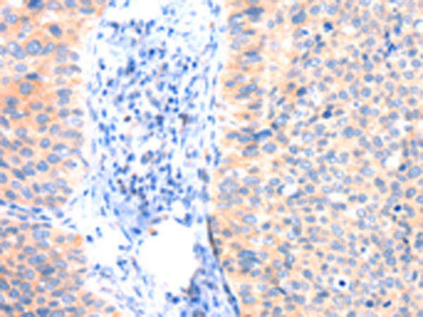 Rabbit Polyclonal Antibody to ANK3