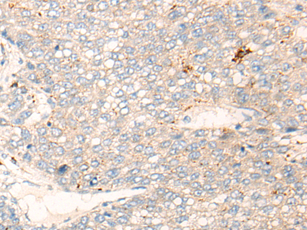 Rabbit Polyclonal Antibody to APOBR