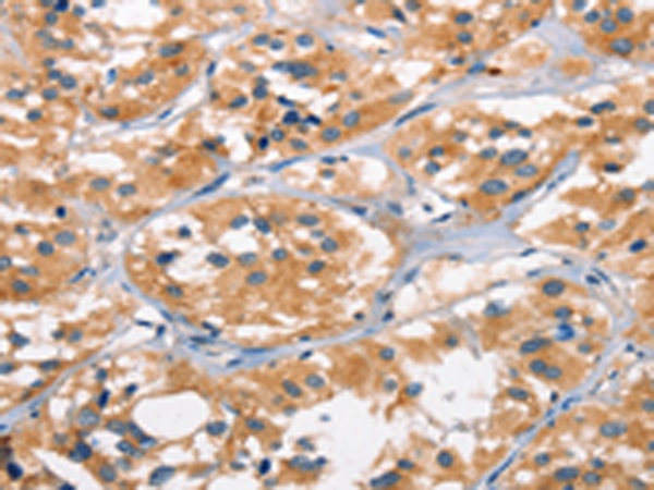 Rabbit Polyclonal Antibody to AHR