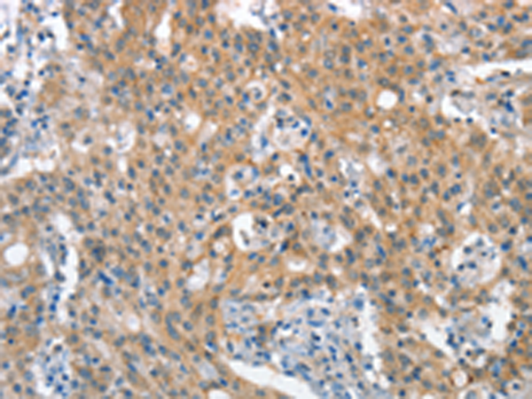 Rabbit Polyclonal Antibody to STAT2