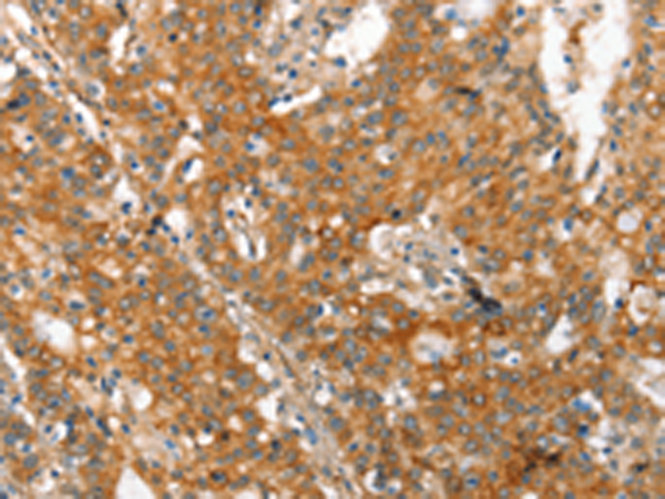 Rabbit Polyclonal Antibody to MMP2