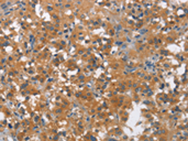 Rabbit Polyclonal Antibody to COX5A