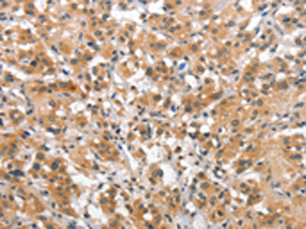 Rabbit Polyclonal Antibody to SMAD1