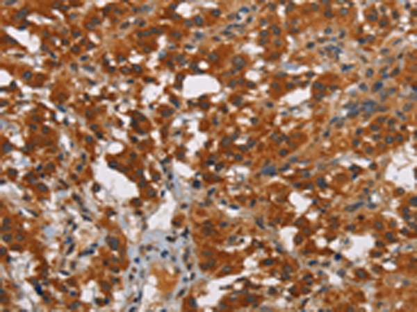 Rabbit Polyclonal Antibody to SMAD9