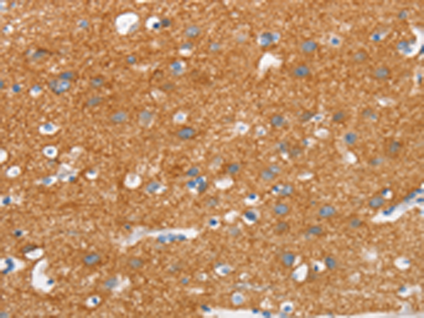 Rabbit Polyclonal Antibody to SNCA