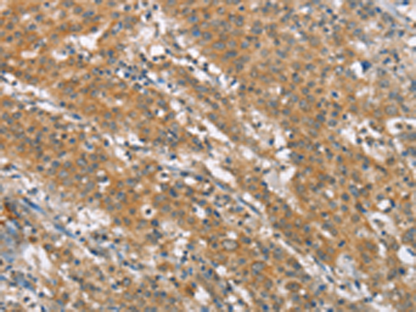 Rabbit Polyclonal Antibody to NLRP7