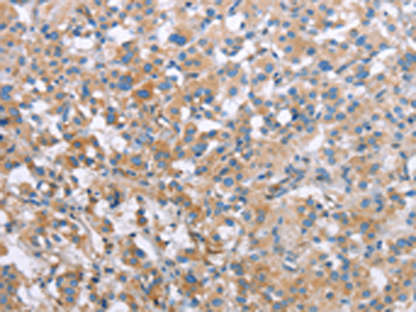 Rabbit Polyclonal Antibody to MCL1
