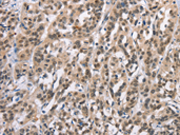 Rabbit Polyclonal Antibody to ADNP
