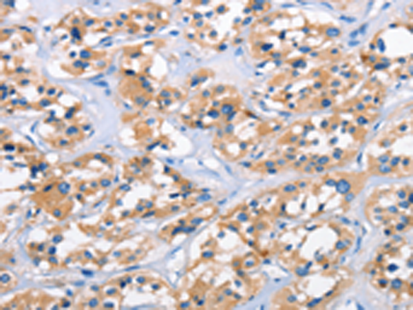 Rabbit Polyclonal Antibody to APOL6