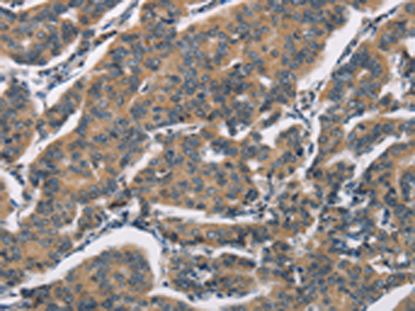 Rabbit Polyclonal Antibody to SH2B2