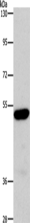 Rabbit Polyclonal Antibody to ARSB
