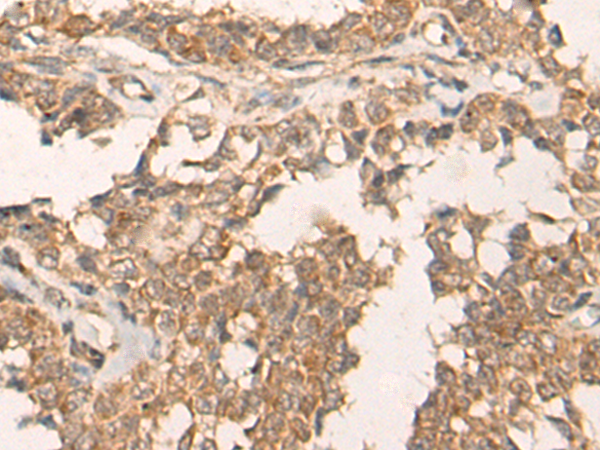 Rabbit Polyclonal Antibody to ATR
