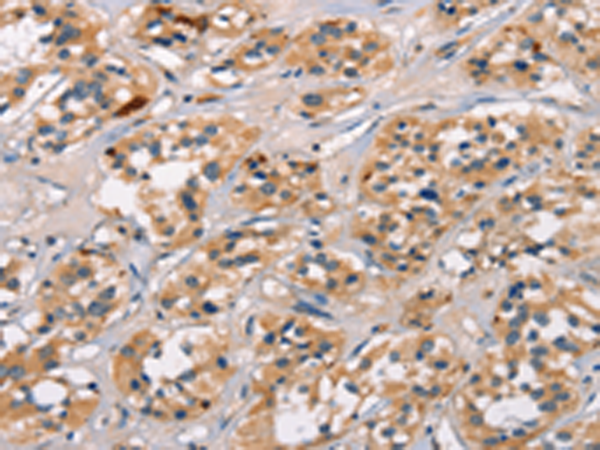 Rabbit Polyclonal Antibody to ATRN