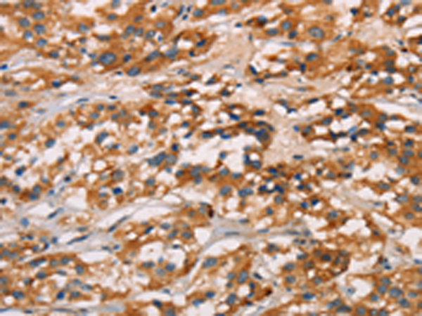 Rabbit Polyclonal Antibody to CD80