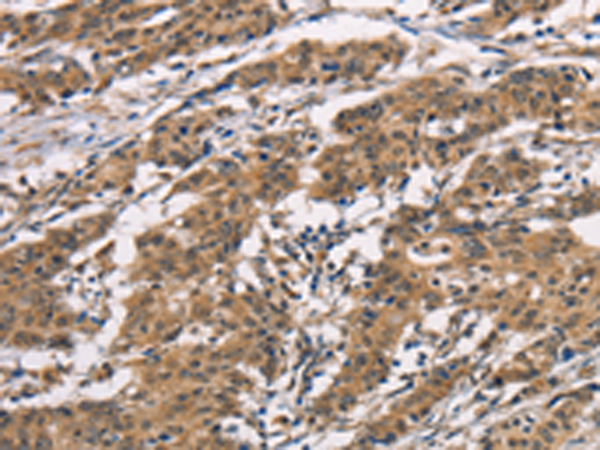 Rabbit Polyclonal Antibody to ADGRB1