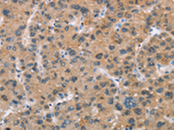 Rabbit Polyclonal Antibody to ADGRB2