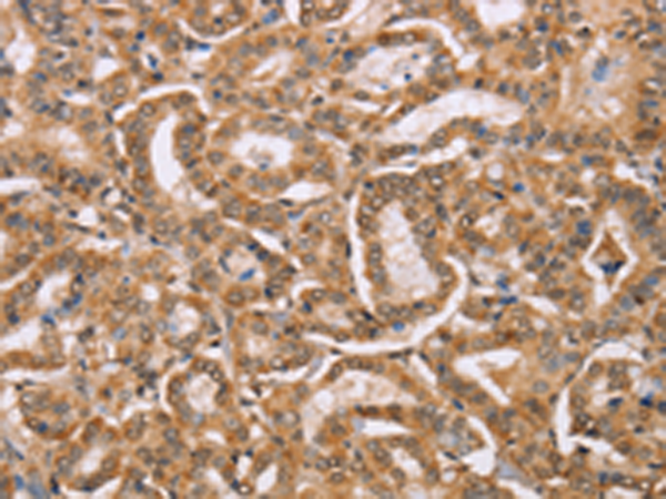Rabbit Polyclonal Antibody to BGLAP