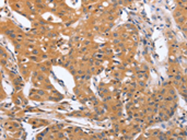 Rabbit Polyclonal Antibody to BLNK