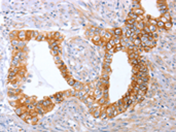 Rabbit Polyclonal Antibody to ABO