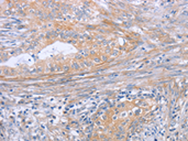 Rabbit Polyclonal Antibody to BOD1