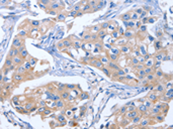 Rabbit Polyclonal Antibody to IBSP