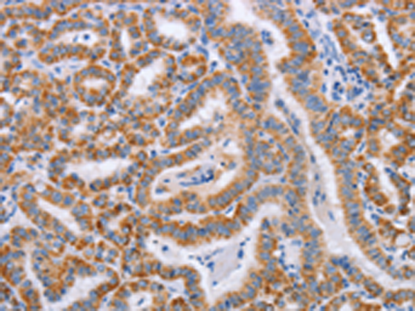 Rabbit Polyclonal Antibody to BST1