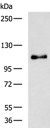 Rabbit Polyclonal Antibody to CBL