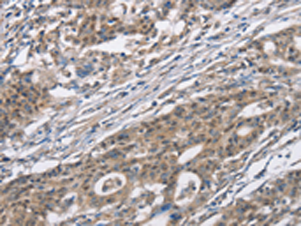 Rabbit Polyclonal Antibody to CACNA1D