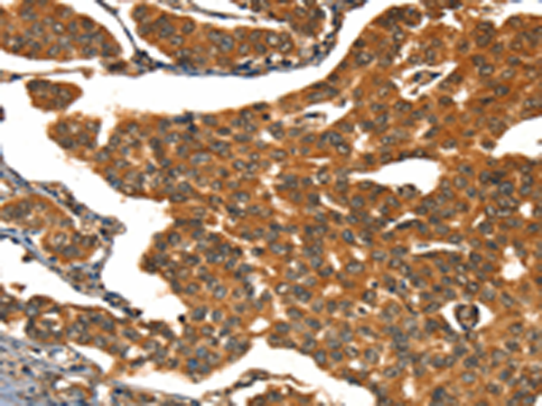 Rabbit Polyclonal Antibody to CACNA1E