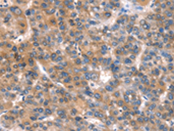 Rabbit Polyclonal Antibody to CACNA1A