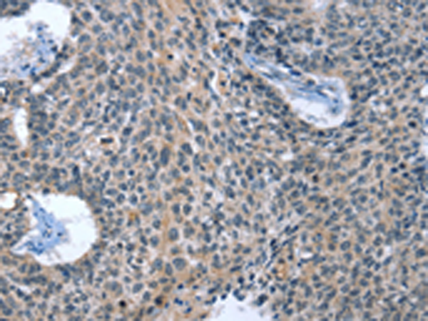 Rabbit Polyclonal Antibody to CAGE1